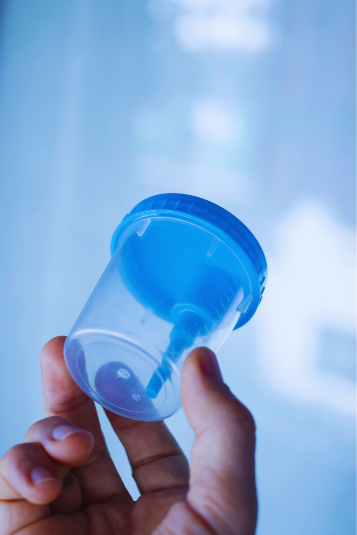 Specimen collection cup for clinic-based drug testing workflow coordination.